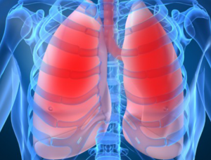 Cintilografia Pulmonar de Perfusão