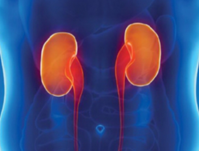 Cintilografia Renal