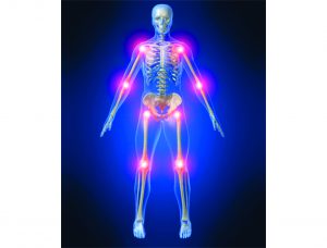 Pesquisa de Corpo Inteiro com Tálio ou Sestamibi
